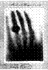 Hand mit Ringen: print of Wilhelm Rntgen's first "medical" x-ray, of his wife's hand, taken on 22 December 1895 and presented to Professor Ludwig  Zehnder of the Physik Institut, University of Freiburg, on 1 January 1896