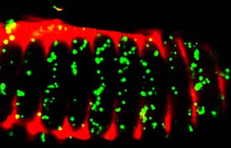 Cell Death